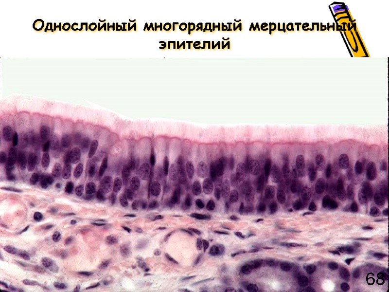 Однослойный многорядный мерцательный эпителий 68
